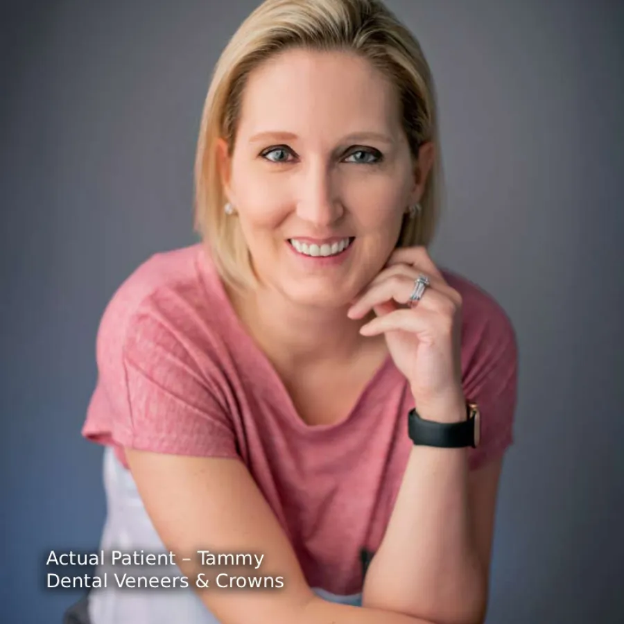 Smiling woman with blonde hair wearing a pink shirt showing white teeth after dental veneers and crowns.