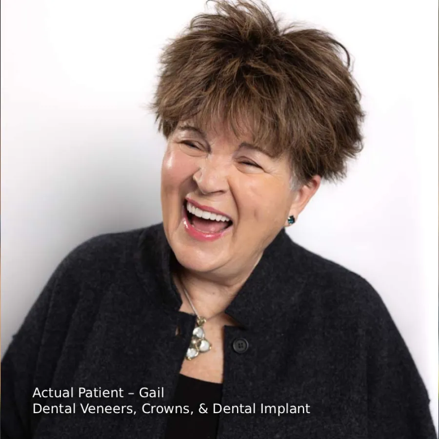 Smiling woman with short brown hair showcasing dental veneers, crowns, and implant results.