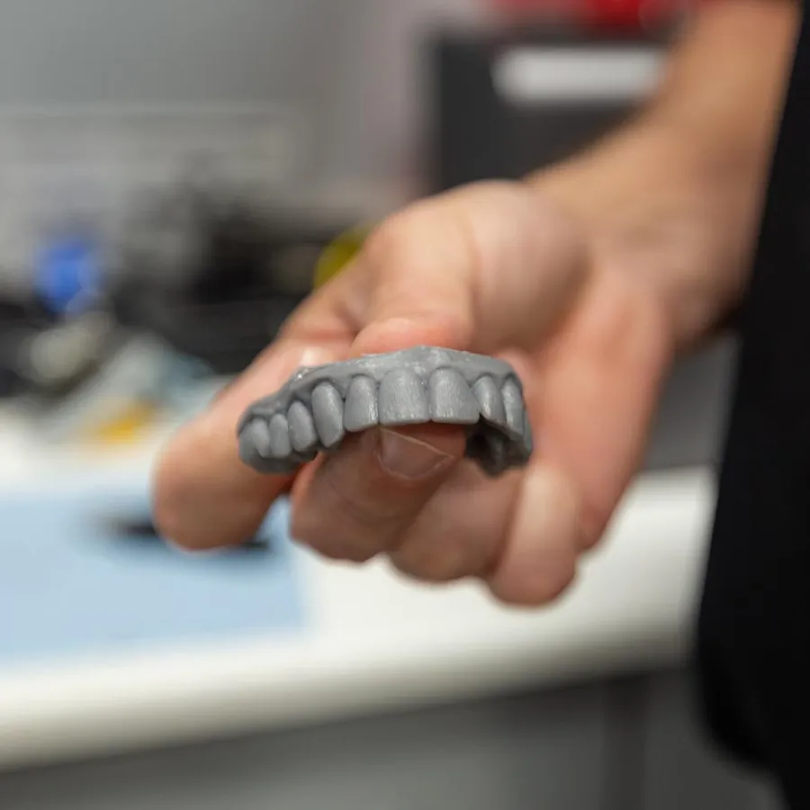 Hand holding a gray dental mold showing upper teeth detail in a blurred indoor setting