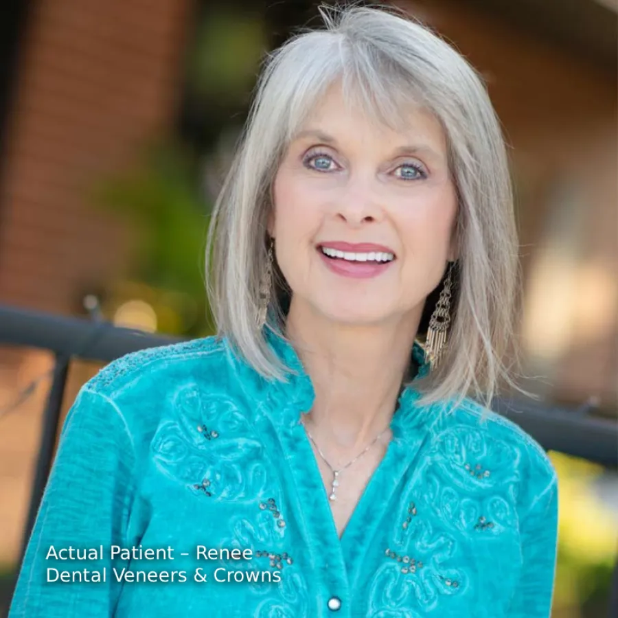 Smiling mature woman with gray hair wearing turquoise blouse showcasing dental veneers and crowns outdoors.
