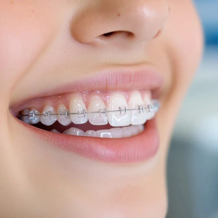 close-up of a person's mouth