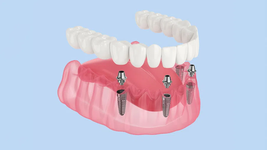 Bright modern dental clinic with dental chair, monitor, sink, and white cabinetry under natural light.