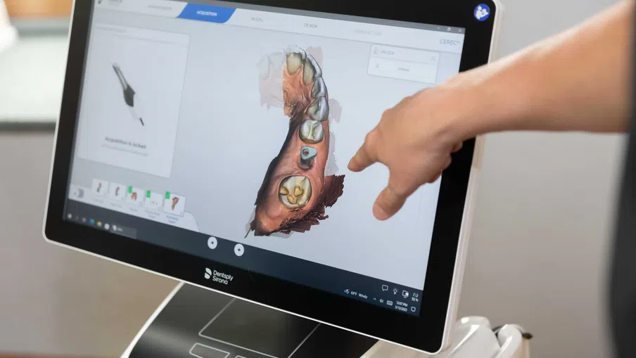 Dental professional pointing at a 3D digital tooth model on a Dentsply Sirona screen for dental treatment planning