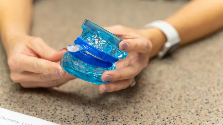 Hands holding a dental model with a blue sleep apnea oral appliance on a speckled countertop.