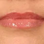 After After 1 syringe of Juvederm Ultra Plus to lips thumbnail