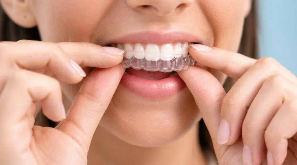 a woman with her mouth open