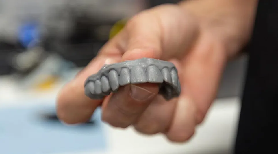 Hand holding a gray dental mold showing upper teeth detail in a blurred indoor setting