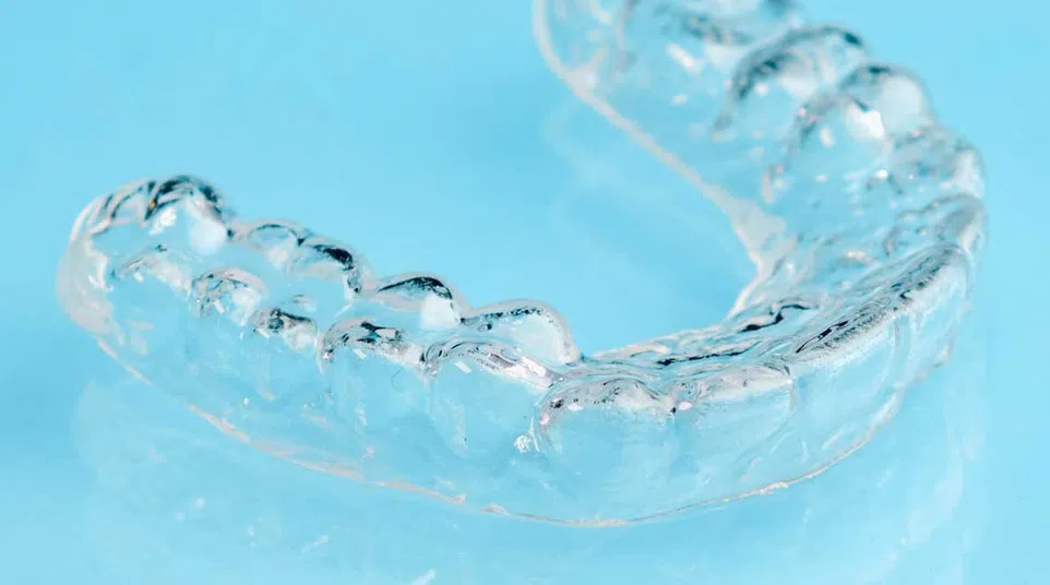 Transparent dental aligner on a blue reflective surface used for teeth straightening.
