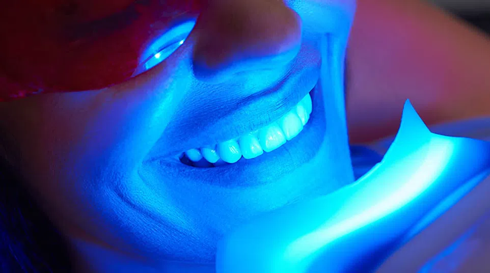 Close-up of woman wearing red protective glasses smiling during blue light teeth whitening treatment.