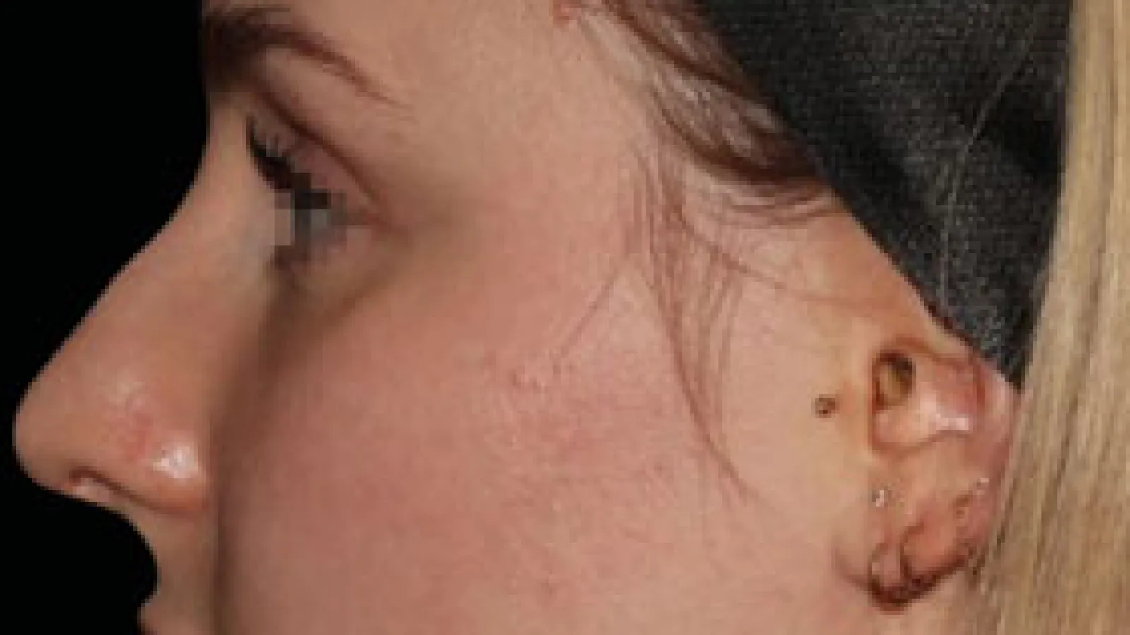 Profile of a young woman with hairband showing clear skin and visible ear piercings on black background