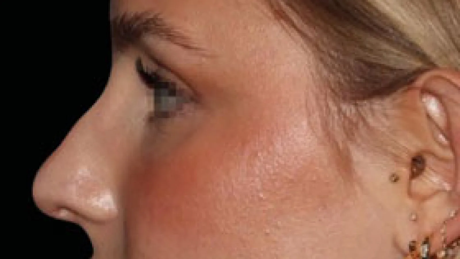 Profile view of a woman with fair skin, blonde hair, and gold hoop earrings against a black background