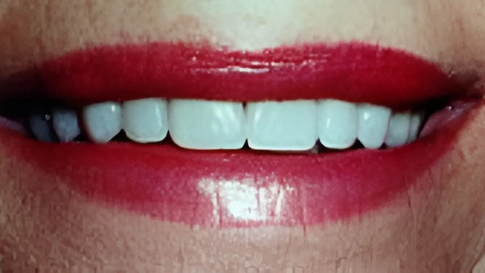 Close-up of a smiling mouth with red lipstick and white teeth on visible skin.