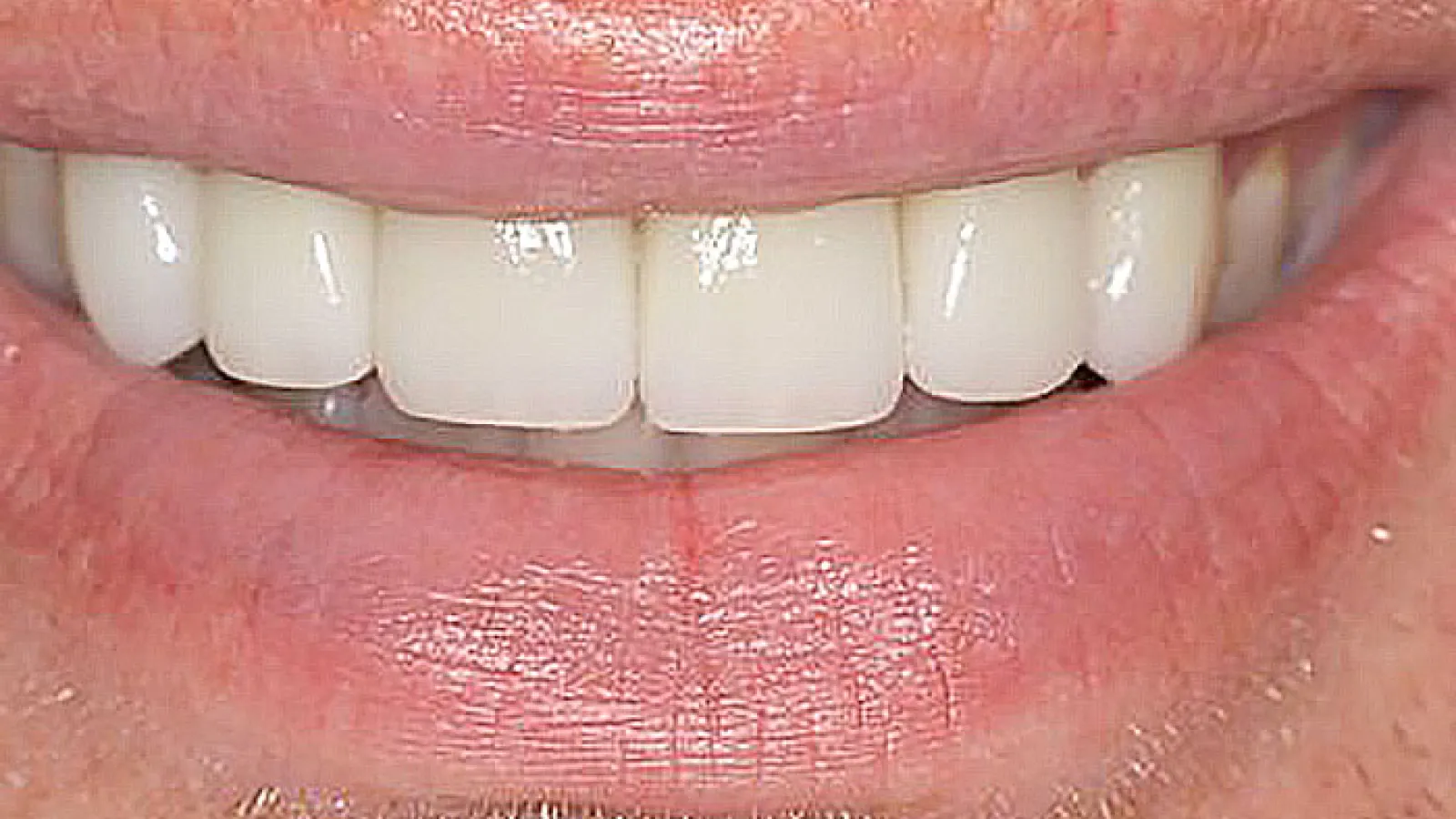 Close-up of a healthy smile showcasing bright, white teeth and pink lips.