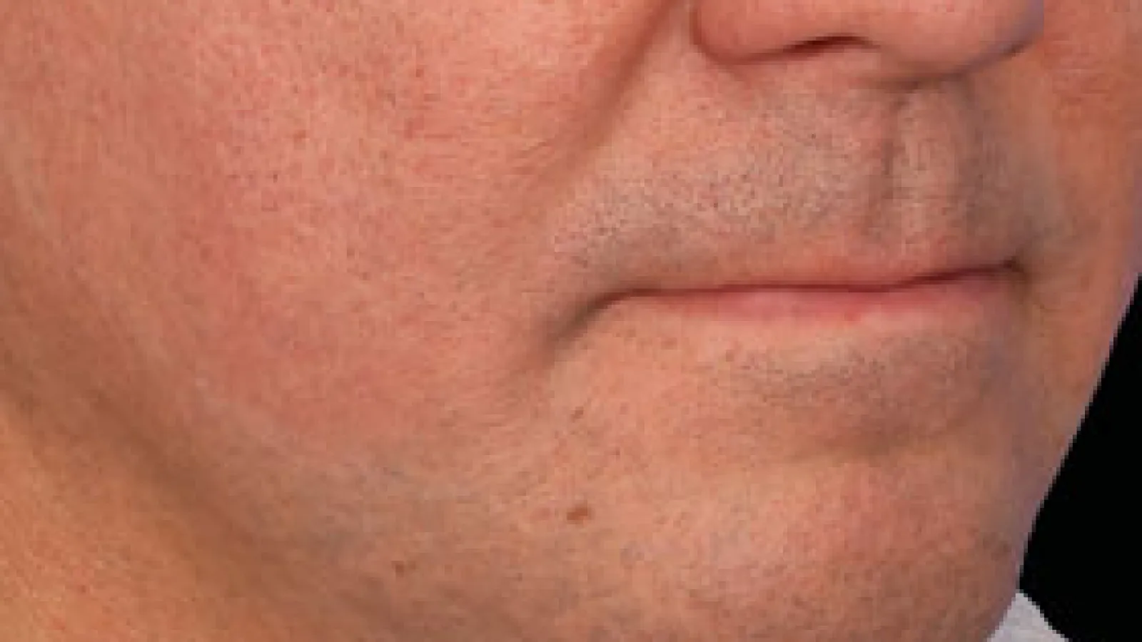 Close-up of a man's lower face showing skin texture, stubble, and neutral lip expression
