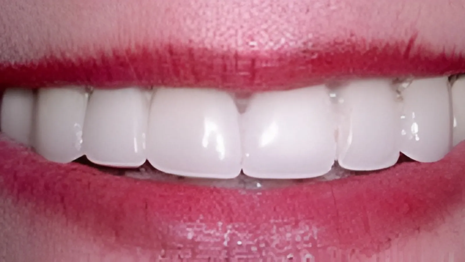 Close-up of a smiling mouth with bright white teeth and red lips showing healthy dental hygiene.
