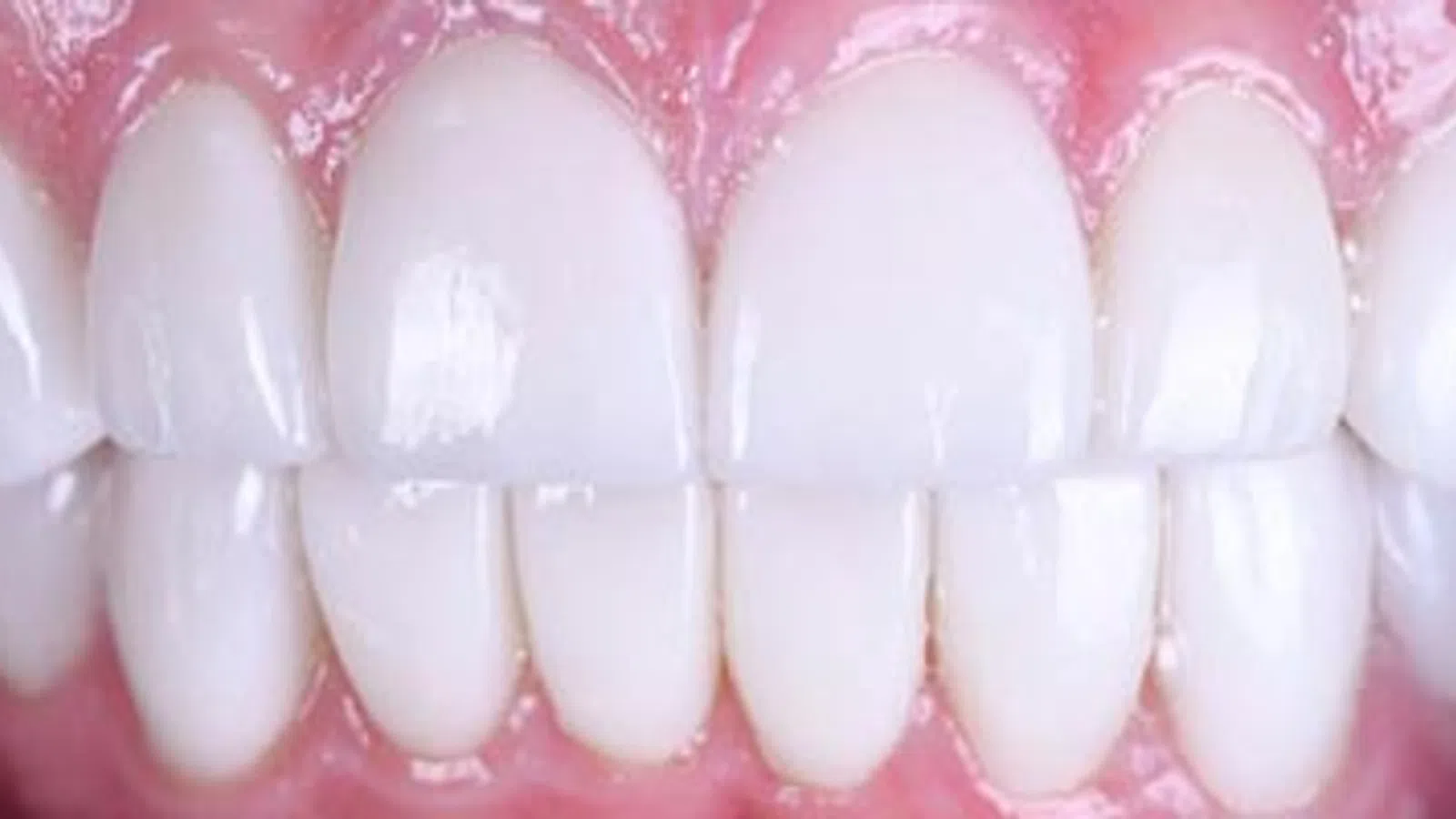 Close-up of healthy, white teeth and pink gums showing clean dental hygiene and well-aligned teeth.