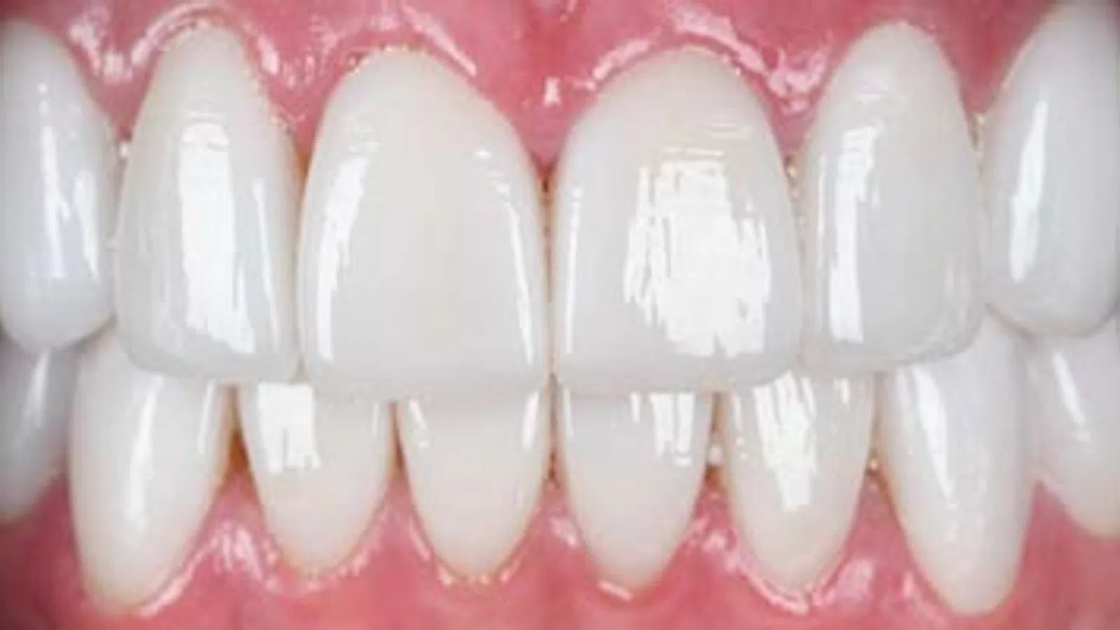 Close-up of bright, clean, white teeth with healthy pink gums and glossy enamel finish, showing a perfect smile.