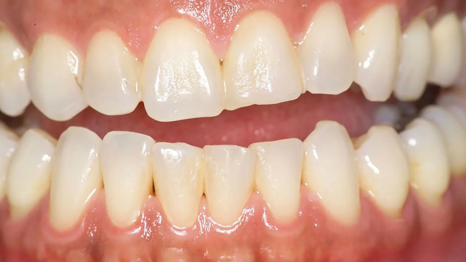 Close-up of healthy human teeth showcasing their whiteness and alignment.