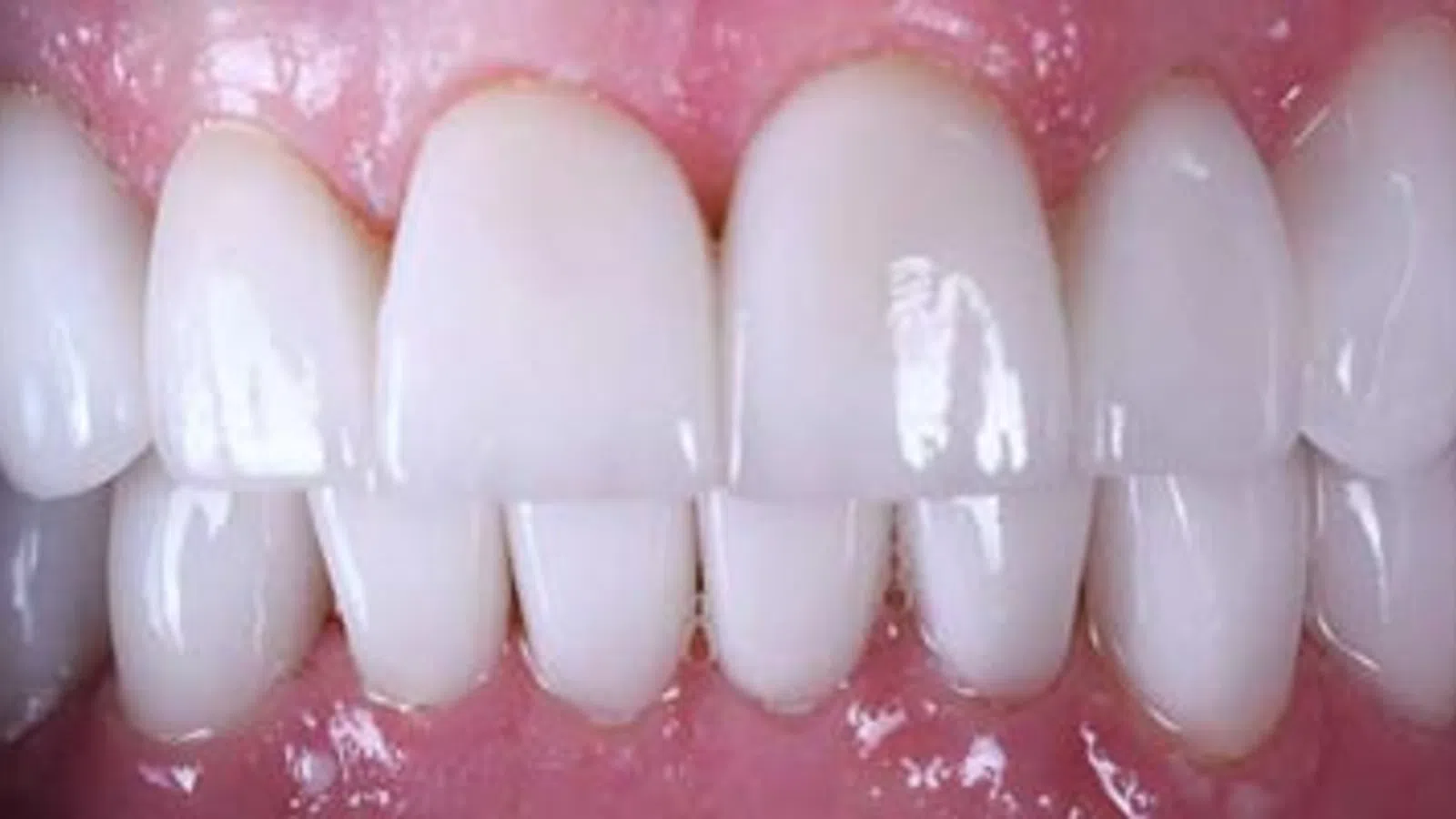 Close-up of healthy white teeth and pink gums with natural shine and smooth texture