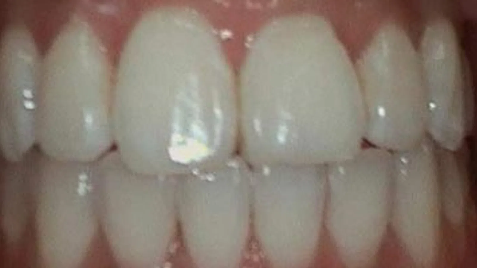 Close-up of healthy, clean human teeth with pink gums and natural shine under light reflection.