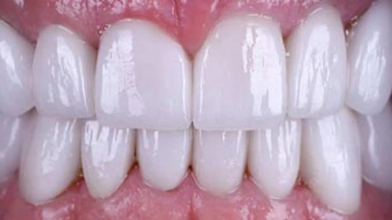Close-up of clean, white teeth with healthy pink gums and natural shine in a smiling mouth.