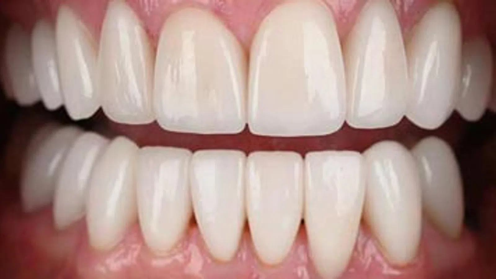 Close-up of a healthy smile showing clean, white, well-aligned teeth and pink gums