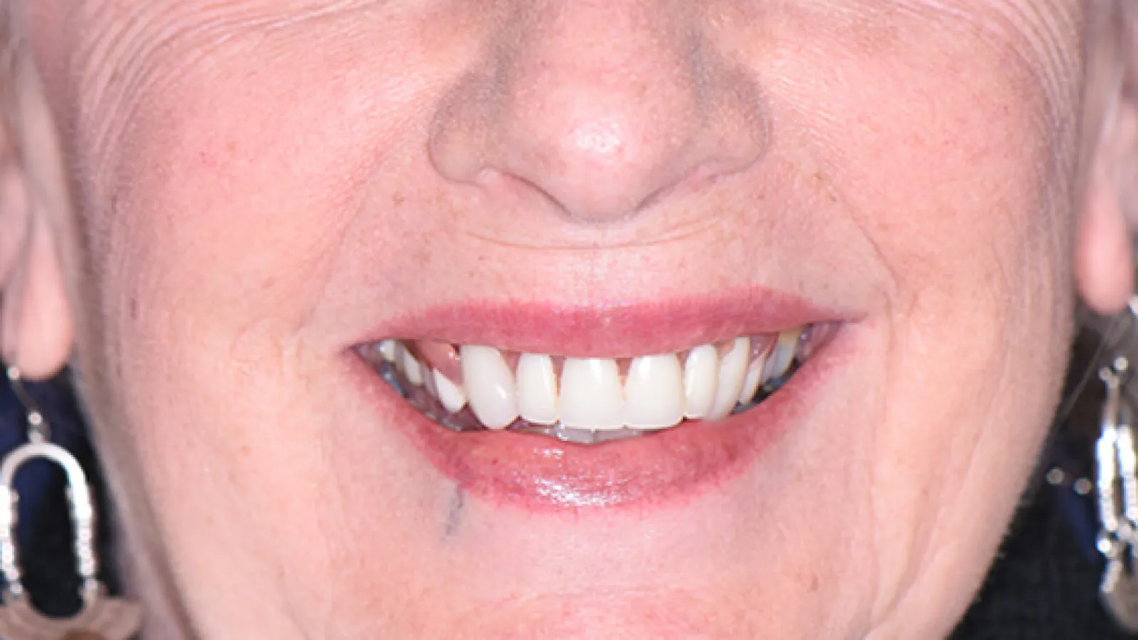 Close-up of a smiling mouth with white teeth and silver earrings on an elderly person.