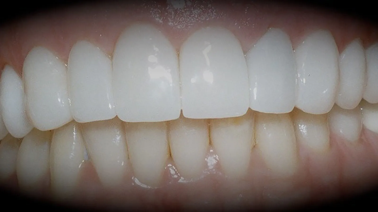 Close-up of a bright, healthy smile with straight, white teeth.