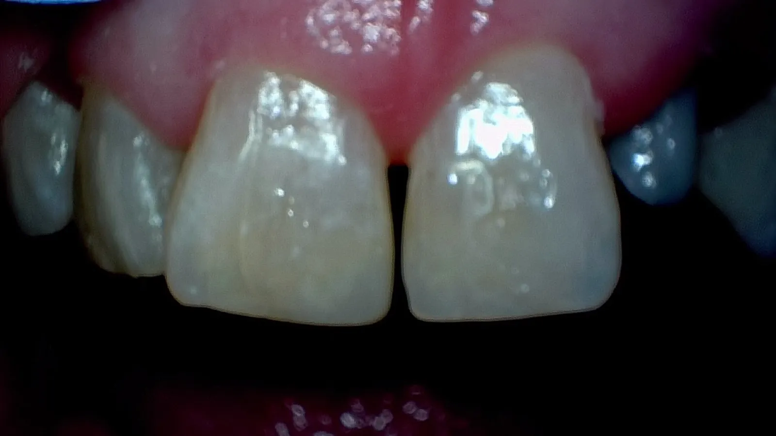 Smile Gallery Auburn, WA | Cook Family Dentistry | Cook Family Dentistry