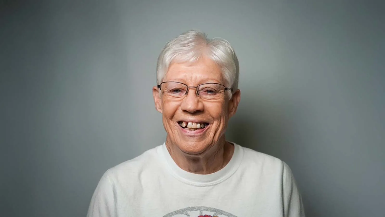 woman with short hair and missing teeth