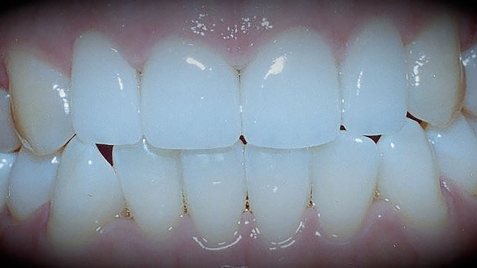 Close-up of healthy white teeth showcasing dental care and oral hygiene.