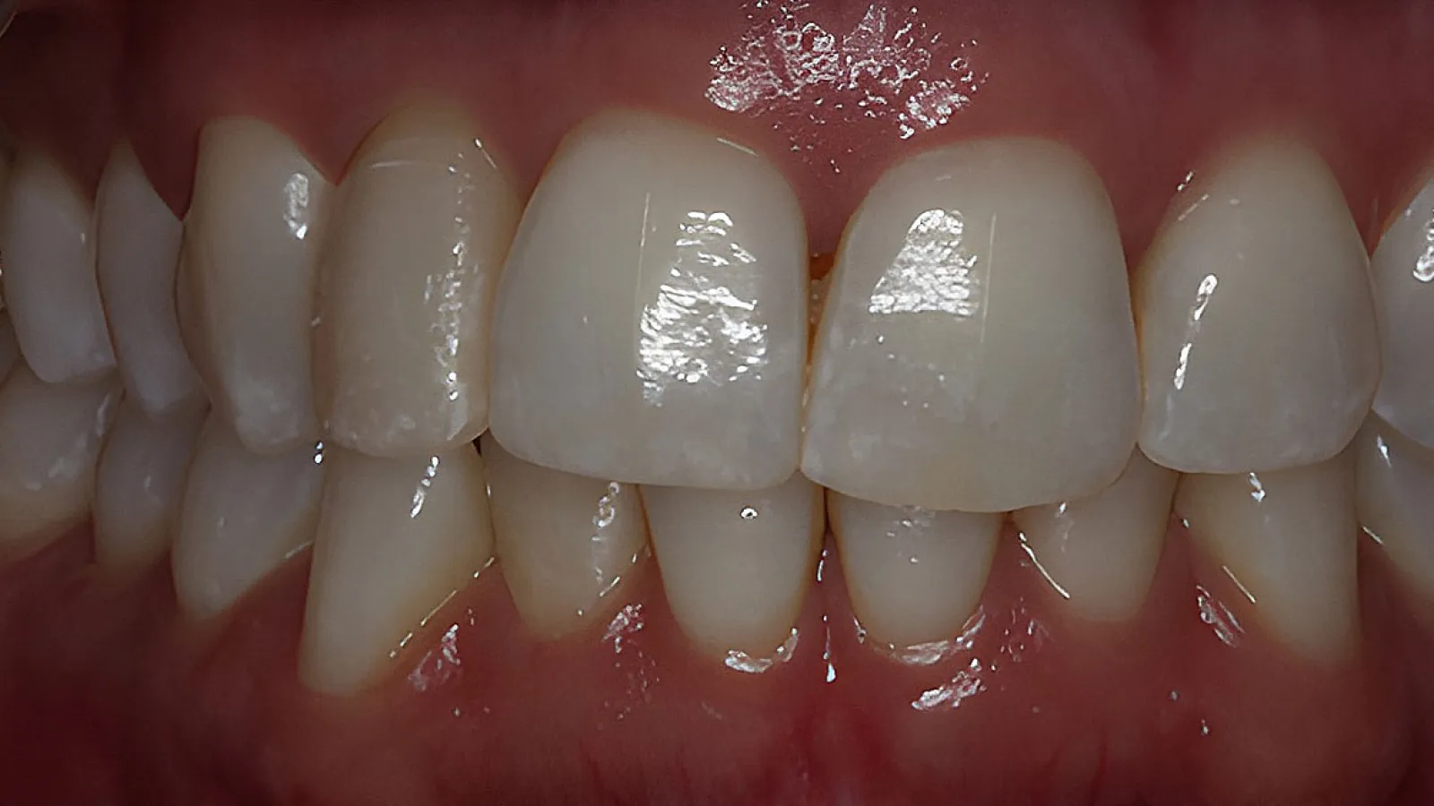 Close-up of clean, healthy human teeth and gums with natural shine and detail.