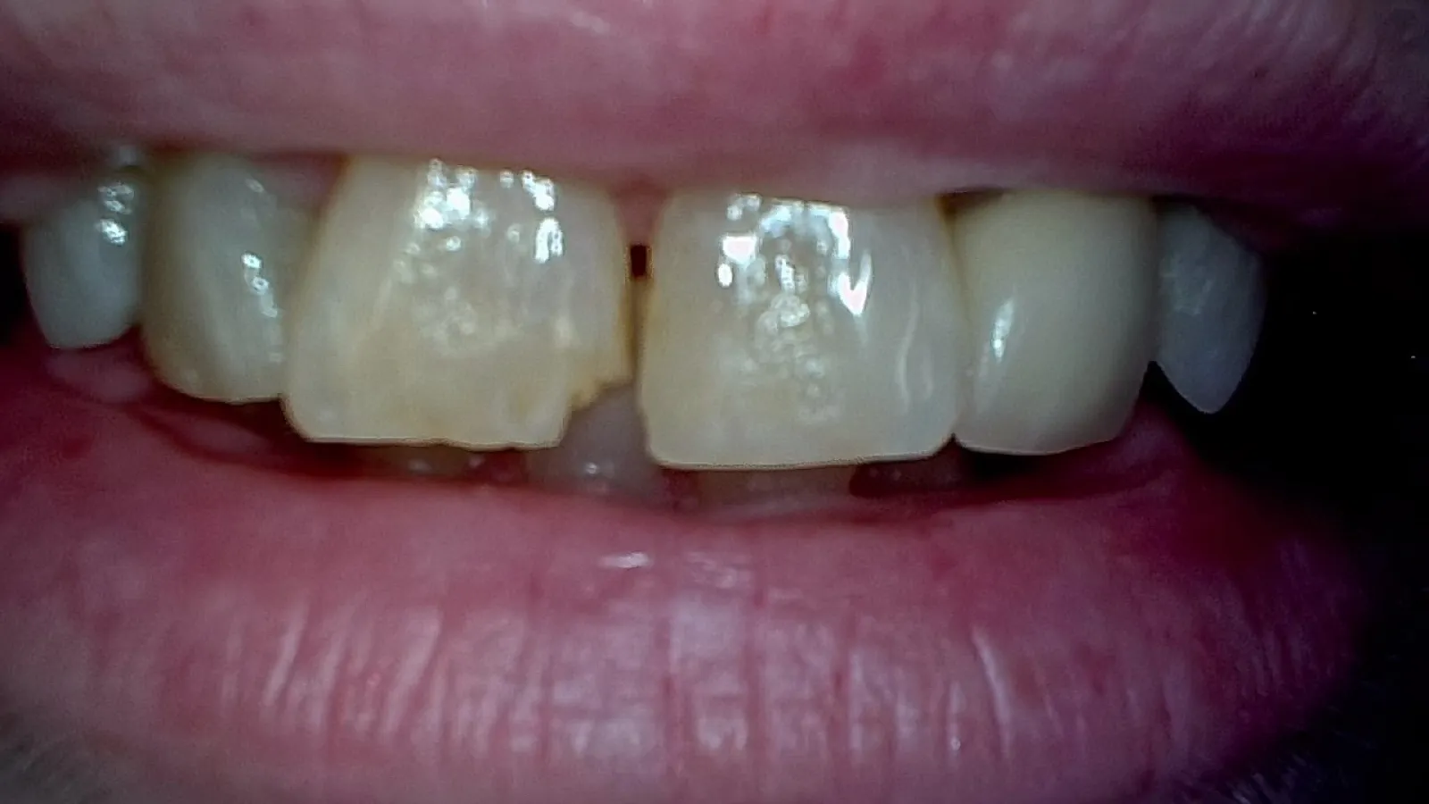 Smile Gallery Auburn, WA | Cook Family Dentistry | Cook Family Dentistry