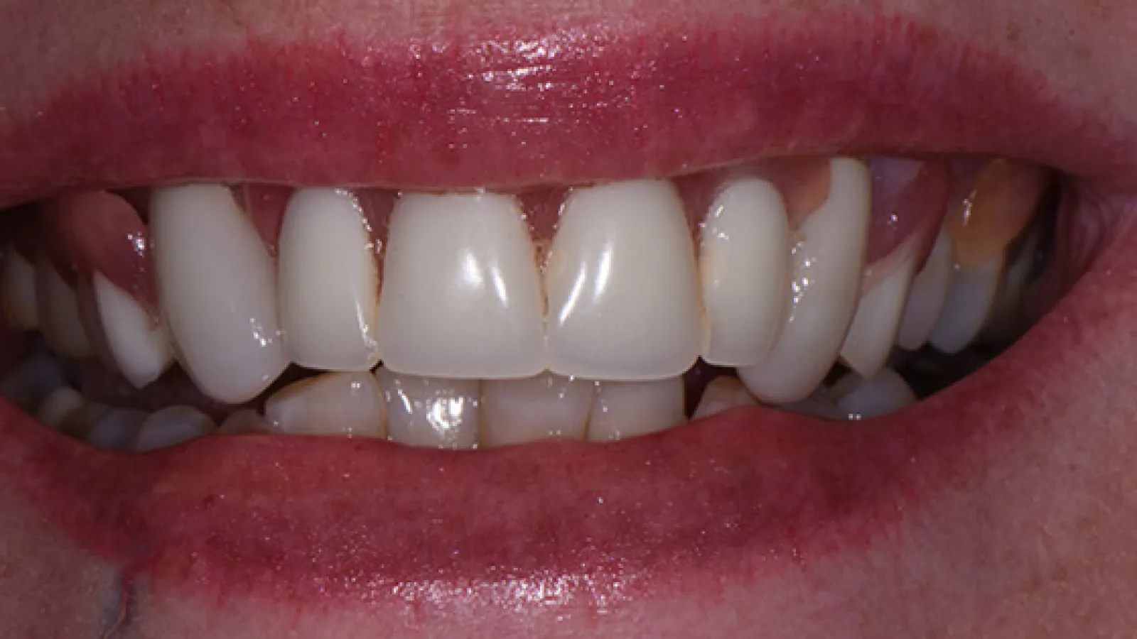 Close-up of a smiling mouth with white, healthy teeth and lips.