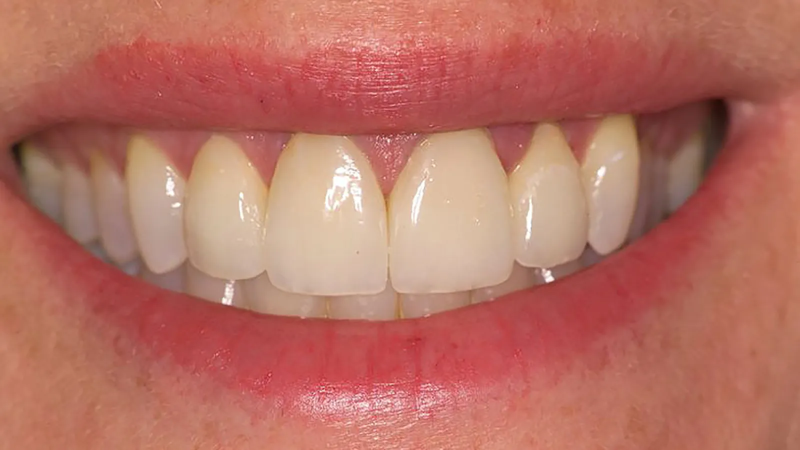 Close-up of a person's smile showing healthy, bright teeth and well-groomed lips.