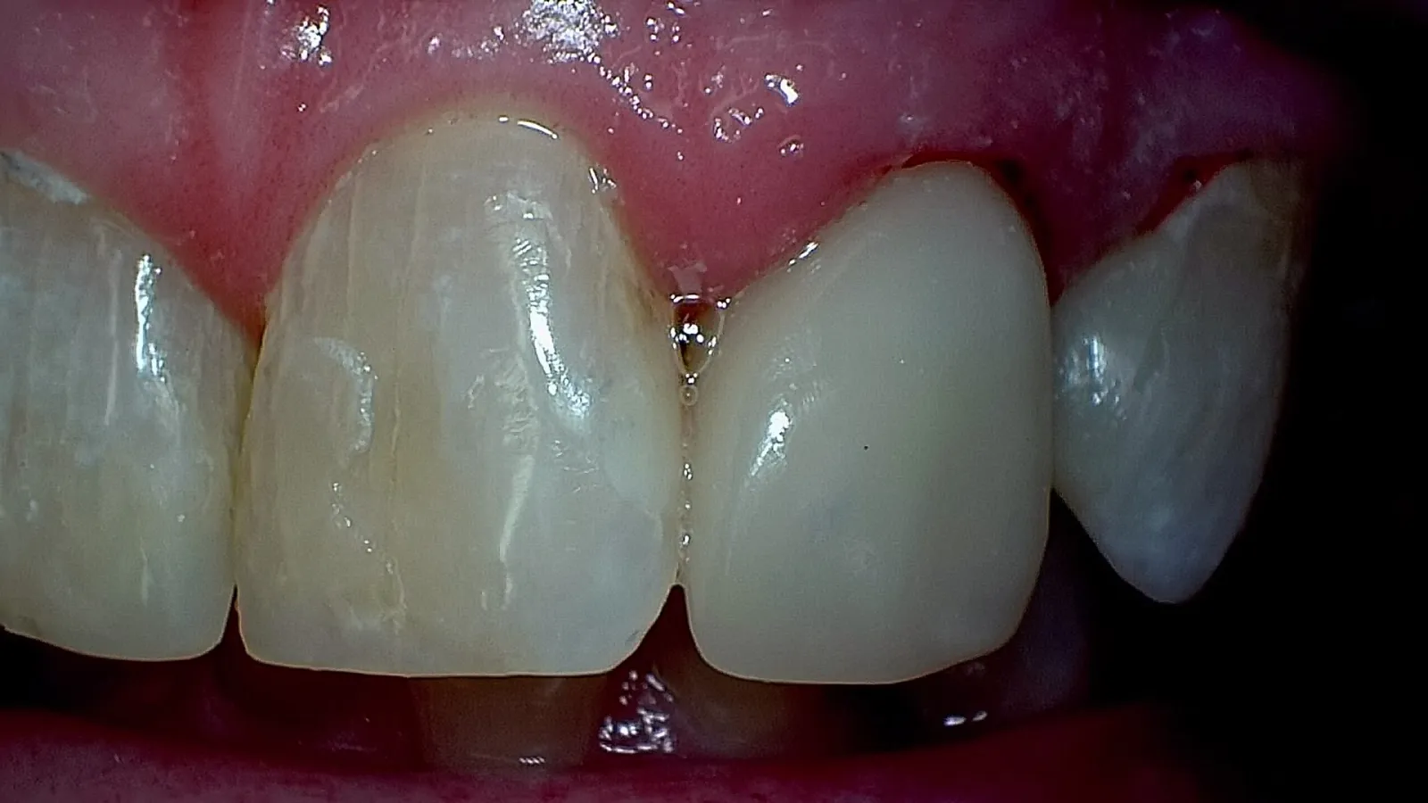 Smile Gallery Auburn, WA | Cook Family Dentistry | Cook Family Dentistry