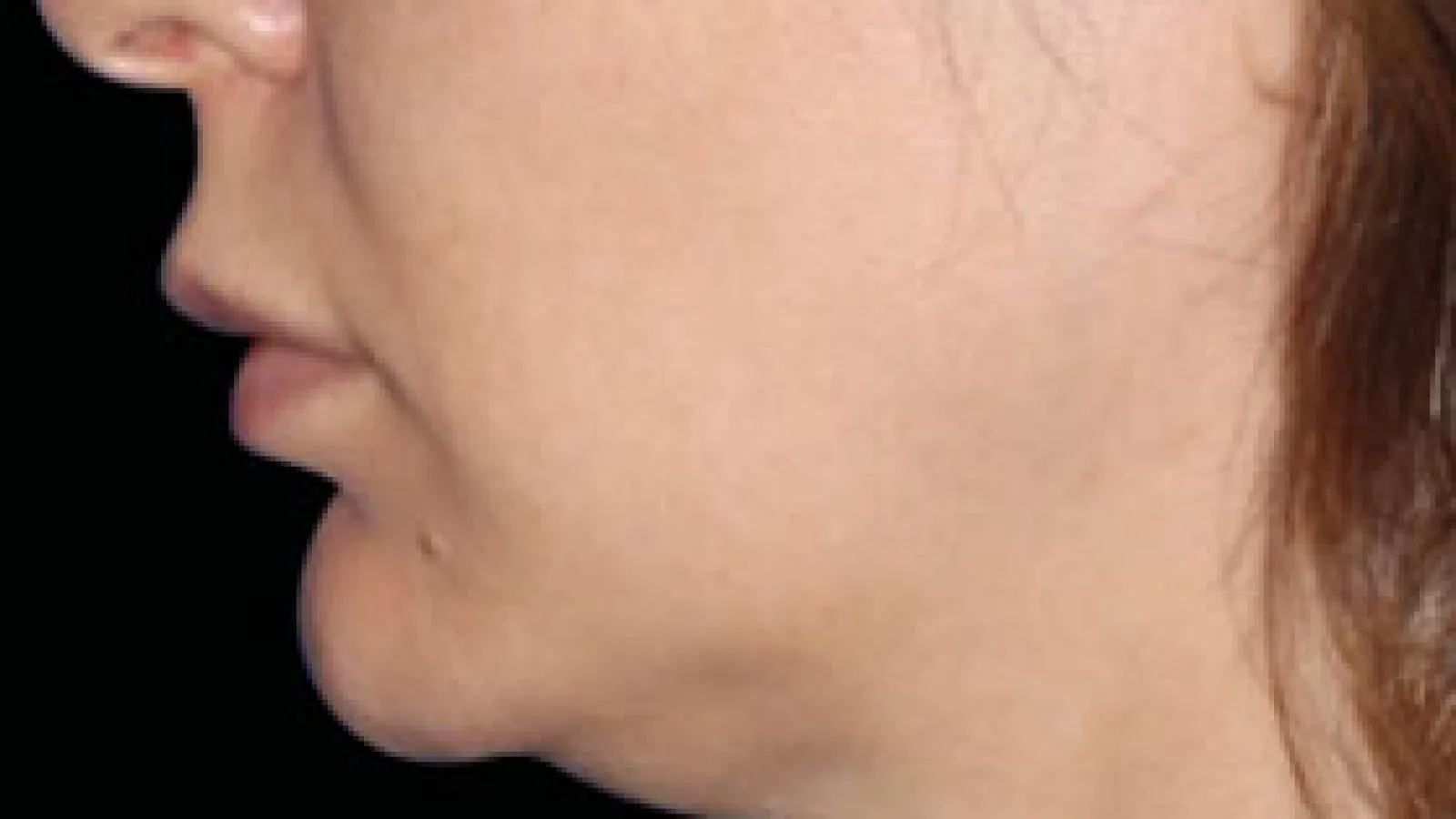 Close-up side view of a woman's lower face and neck showing smooth skin and natural contours.