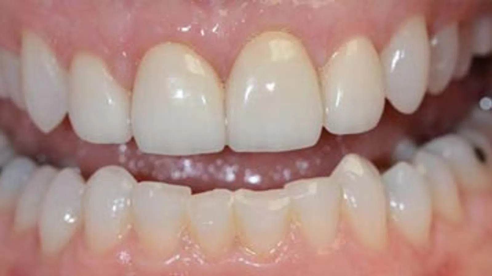 Close-up of a healthy human smile showing well-aligned upper and lower teeth with natural gums.