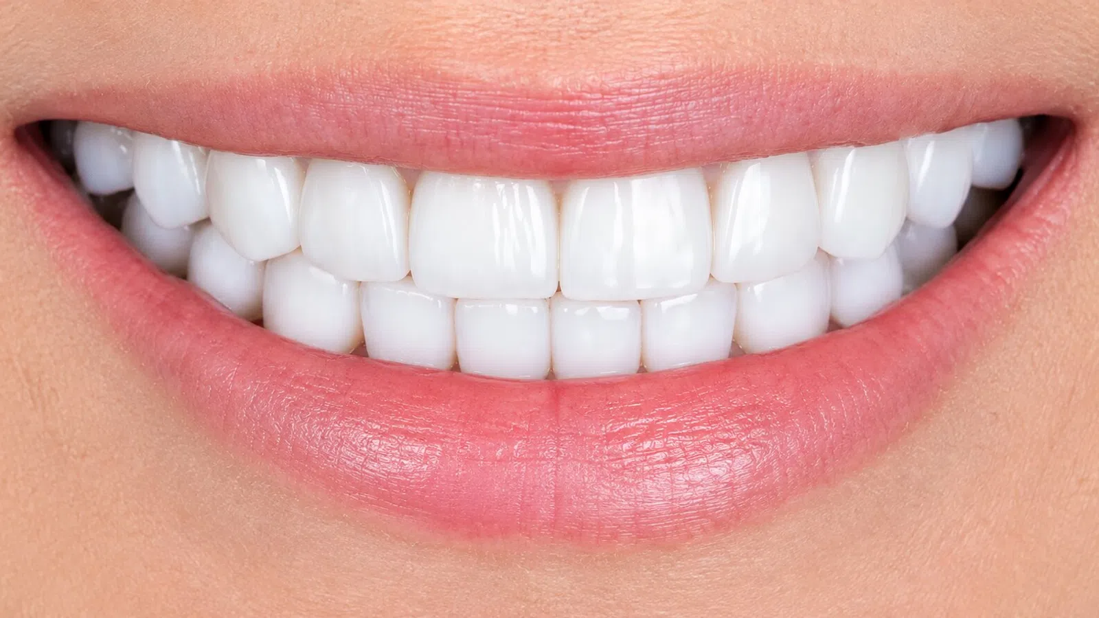 Close-up of bright white teeth with healthy pink lips smiling naturally.