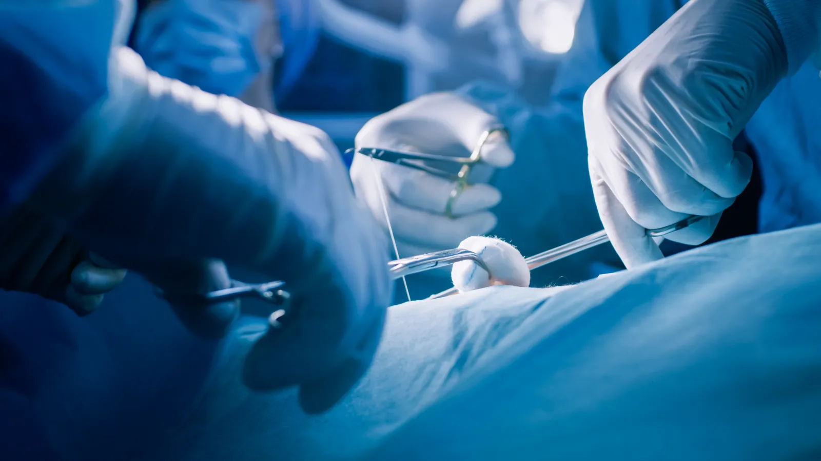 people performing a surgery