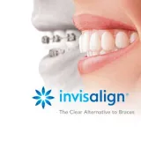 Invisalign Clear Braces for Straight Teeth in Kennesaw