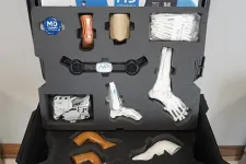 Thumbnail for Medical training kit for clubfoot treatment with foot models, braces, and anatomical parts in a black carrying case.