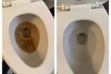 Thumbnail for Side-by-side comparison of a toilet bowl before and after deep cleaning, showing removal of brown stains.