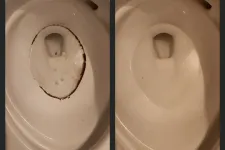 Thumbnail for Side-by-side comparison of a toilet bowl before and after deep cleaning removing dark stains and grime.
