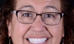 Thumbnail control image for a woman wearing glasses