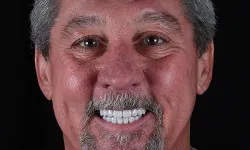 Thumbnail control image for a man with a beard