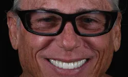 Thumbnail control image for a man wearing glasses
