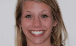 Thumbnail control image for Close-up of a smiling young woman with blue eyes and blonde hair against a plain white background