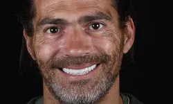 Thumbnail control image for a man smiling for the camera