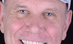 Thumbnail control image for a man wearing a white hat